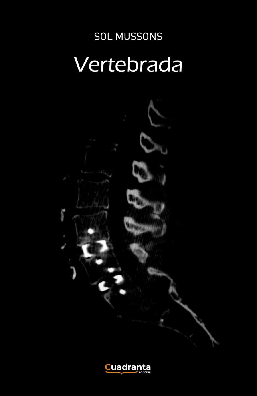 VERTEBRADA | 9788410397132 | MUSSONS MORA, SOL