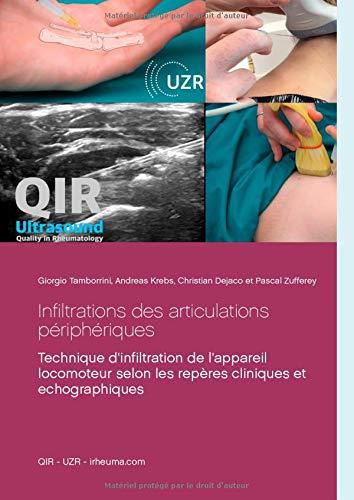 INFILTRATIONS DES ARTICULATIONS PERIPHERIQUES | 9783744867924 | TAMBORRINI, GIORGIO / KREBS, ANDREAS / DEJACO, CHRIS