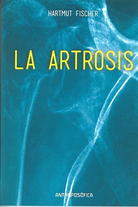 ARTROSIS, LA | 9789879066669 | FISCHER, HARTMUT