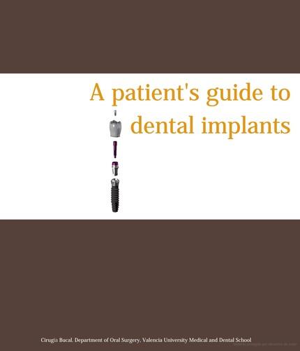 A PATIENT'S GUIDE TO DENTAL IMPLANTS | 9788437094427 | PEÑARROCHA DIAGO, MARÍA / PEÑARROCHA DIAGO, DAVID / VELARTE SAEZ, ROSARIO