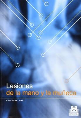 LESIONES DE LA MANO Y LA MUÑECA | 9788480198233 | IRISARRI CASTRO, C.