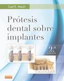 PROTESIS DENTAL SOBRE IMPLANTES (2ª ED) | 9788490228630 | MISCH, CARL E.