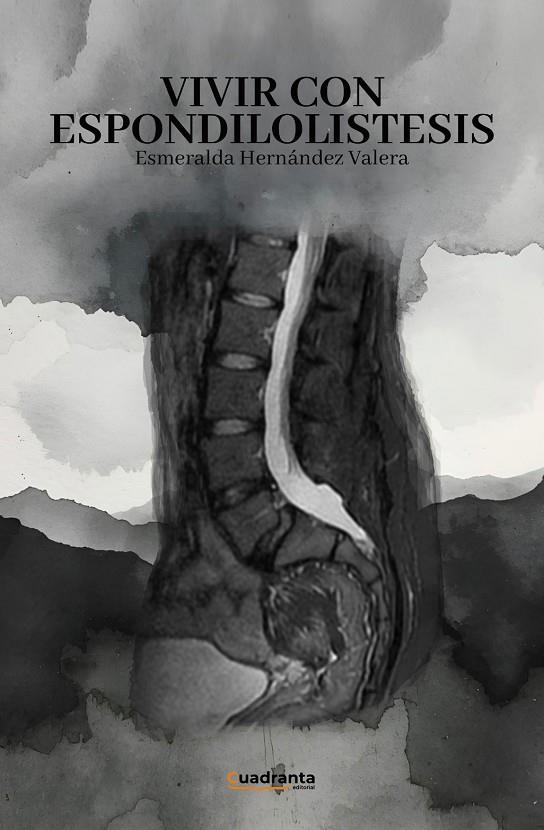 VIVIR CON ESPONDILOLISTESIS | 9791387773625 | HERNANDEZ VALERA, ESMERALDA