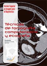 TÉCNICAS DE TOMOGRAFÍA COMPUTARIZADA Y ECOGRAFÍA | 9788416293179