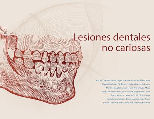LESIONES DENTALES NO CARIOSAS | 9789978389478 | DEL CARMEN, ANA