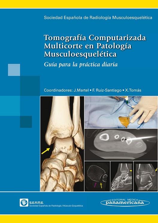 TOMOGRAFIA COMPUTARIZADA MULTICORTE EN PATOLOGIA MUSCULOESQUELÉTICA | 9788498355192 | SERME SOCIEDAD ESPAÑOLA DE RADIOLOGÍA MUSCULOESQUELÉTICA/JOSÉ MARTEL VILLAGRÁN/FERNANDO RUIZ SANTIAG