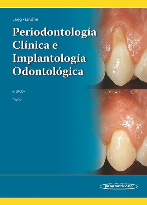 PERIODONTOLOGIA CLINICA E IMPLANTOLOGIA ODONTOLOGICA. TOMO 2 | 9789500694940 | LINDHE / LANG