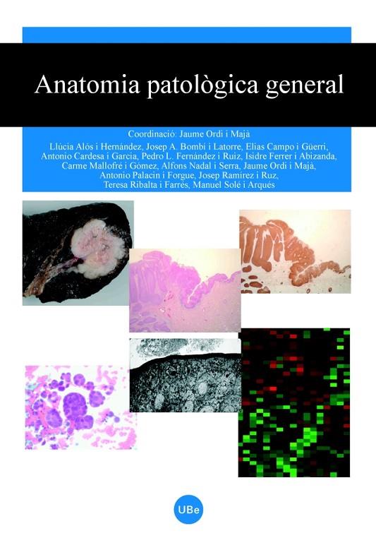 ANATOMIA PATOLÒGICA GENERAL | 9788447531295 | ORDI I MAJÀ, JAUME