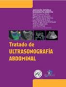 TRATADO DE ULTRASONOGRAFÍA ABDOMINAL | 9788479789732 | CUENCA MORÓN, BEATRIZ
