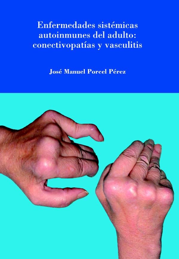 ENFERMEDADES SISTÉMICAS AUTOINMUNES DEL ADULTO: CONECTIVOPATÍAS Y VASCULITIS | 9788484092056 | PORCEL PÉREZ, JOSE MANUEL