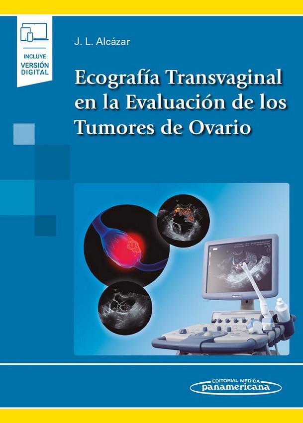 ECOGRAFIA TRANSVAGINAL EN LA EVALUACION DE LOS TUMORES DE OVARIO | 9788491104971 | ALCAZAR ZAMBRANO, JUAN LUIS