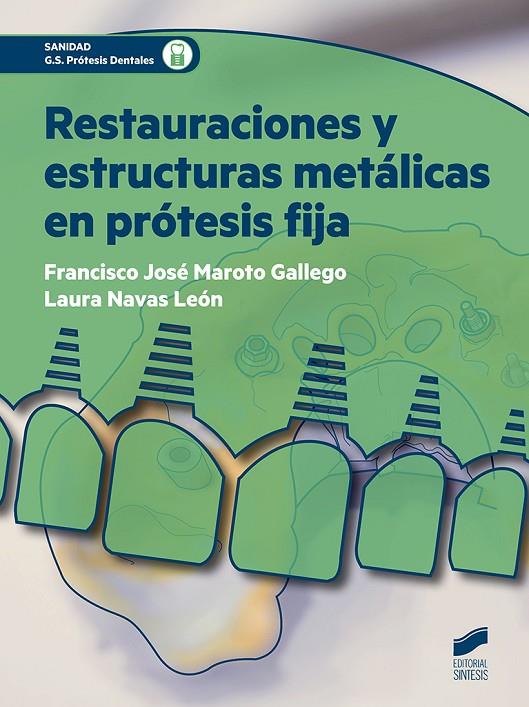 RESTAURACIONES Y ESTRUCTURAS METÁLICAS EN PRÓTESIS FIJA | 9788491710172 | MAROTO GALLEGO, FRANCISCO JOSÉ / NAVAS LEÓN, LAURA