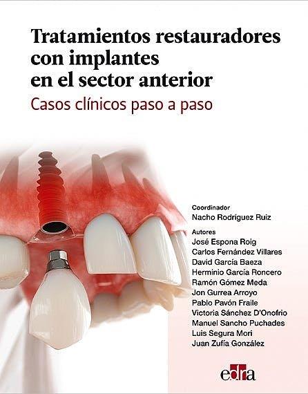 TRATAMIENTOS RESTAURADORES CON IMPLANTES EN EL SECTOR ANTERIOR | 9788418706431 | ESPONA ROIG,  JOSE / FERNANDEZ VILLARES, C.