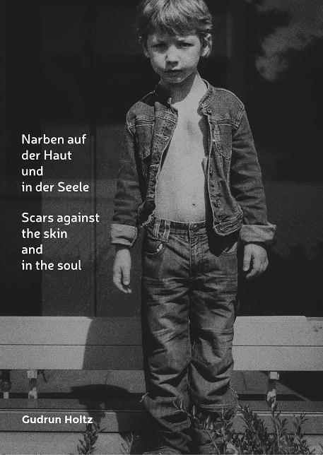NARBEN AUF DER HAUT UND IN DER SEELE | 9783750493148 | HOLTZ, GUDRUN