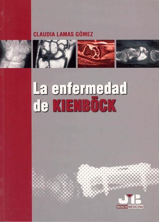 ENFERMEDAD DE KIENB(TM)CK, LA | 9788476987407 | LAMAS GOMEZ, CLAUDIA