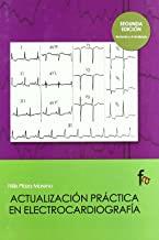 ACTUALIZACION PRACTICA EN ELECTROCARDIOGRAFIA | 9788496804418 | PLAZA MORENO, FELIX