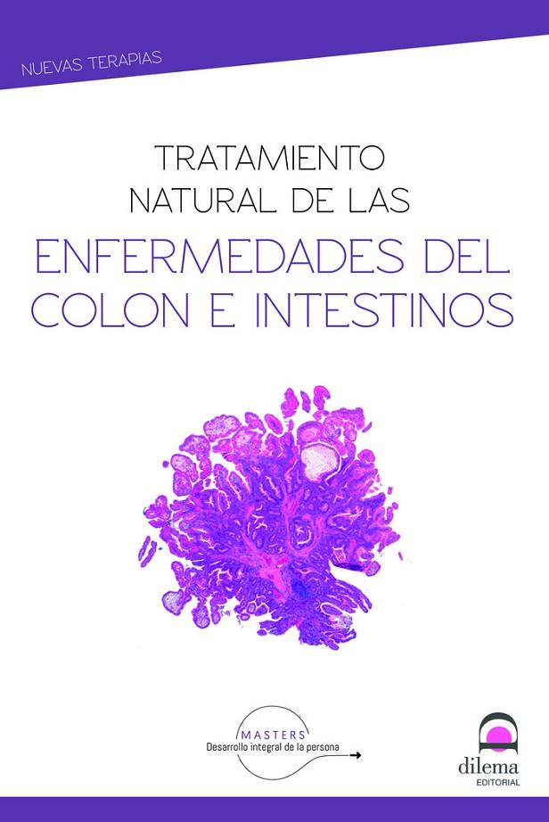 TRATAMIENTO NATURAL DE ENFERMEDADES DEL COLON E INTESTINOS | 9788498275353 | DESARROLLO INTEGRAL DE LA PERSONA, MASTERS