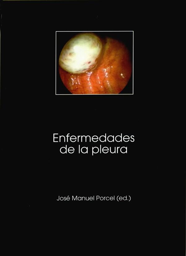 ENFERMEDADES DE LA PLEURA | 9788484091073 | PORCEL PÉREZ, JOSE MANUEL