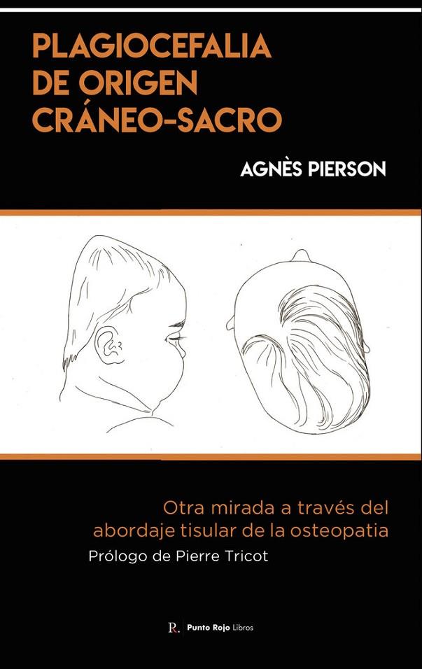PLAGIOCEFALIA DE ORIGEN CRÁNEO-SACRO | 9788419537461 | HERNÁNDEZ CALLEJO, MIGUEL