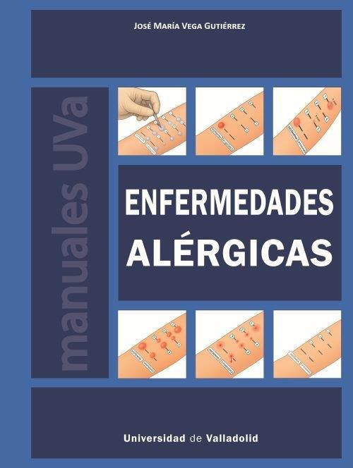 ENFERMEDADES ALERGICAS | 9788413203768 | VEGA GUTIERREZ, JOSE MARIA