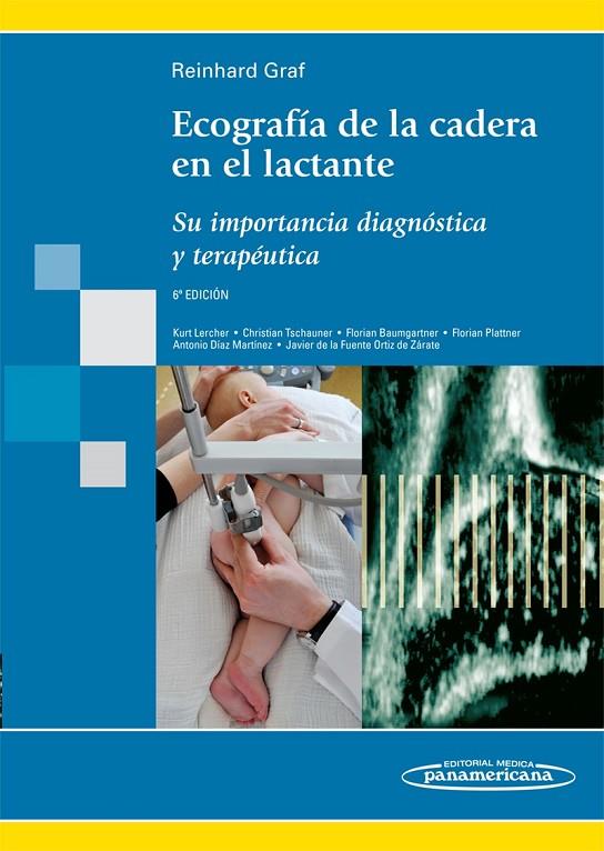 ECOGRAFIA DE LA CADERA EN EL LACTANTE | 9788498353877 | REINHARD, GRAF