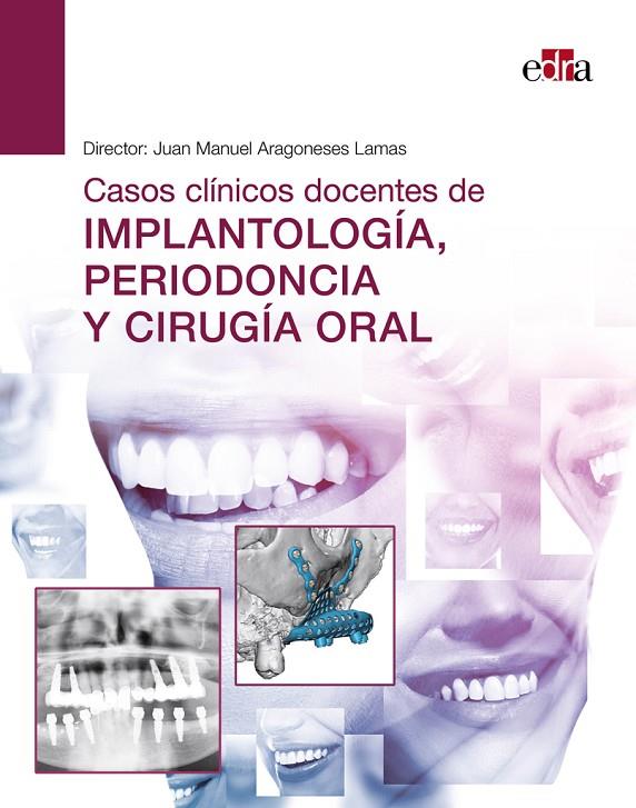 CASOS CLINICOS DOCENTES DE IMPLANTOLOGIA, PERIODONCIA Y CIRUGIA ORAL | 9788418706554 | ARAGONESES, JUAN MANUEL