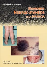 SINDROMES NEUROCUTANEOS EN LA INFANCIA | 9788477628064 | PALENCIA LUACES, RAFAEL
