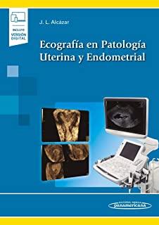 ECOGRAFIA EN PATOLOGIA UTERINA Y ENDOMETRIAL | 9788491106135 | ALCAZAR ZAMBRANO, JUAN LUIS
