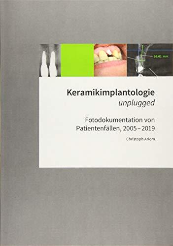 KERAMIKIMPLANTOLOGIE UNPLUGGED | 9783749478675 | ARLOM, CHRISTOPH