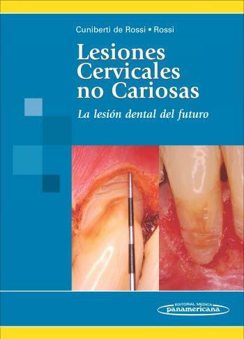 LESIONES CERVICALES NO CARIOSAS | 9789500682480 | CUNIBERTI DE ROSSI, ROSSI