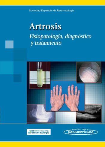 ARTROSIS. FISIOPATOLOGIA, DIAGNOSTICO Y TRATAMIENTO | 9788498353303 | MONFORT FAURE, JORDI