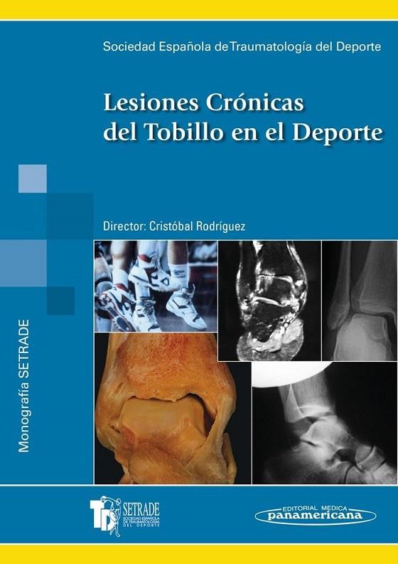 LESIONES CRONICAS DEL TOBILLO EN EL DEPORTE | 9788479037925 | RODRIGUEZ HERNANDEZ, CRISTOBAL