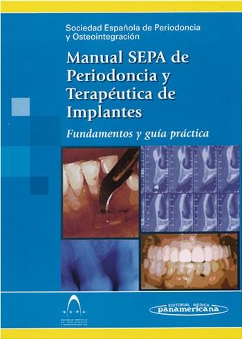 MANUAL SEPA DE PERIODONCIA Y TERAPEUTICA DE IMPLANTES | 9788479038793 | ECHEVERRIA GARCIA, JOSE JAVIER
