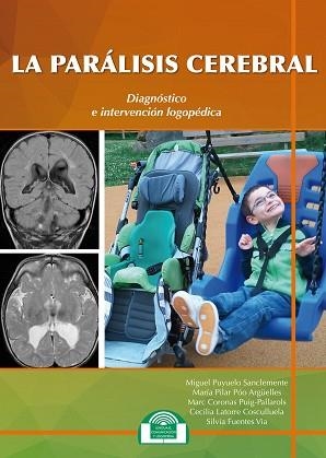 PARALISIS CEREBBRAL, LA | 9788497277037 | PUYUELO SANCLEMENTE, MIGUEL