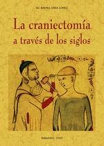 CRANIECTOMÍA A TRAVÉS DE LOS SIGLOS, LA | 9788490016008 | VARA LÓPEZ, RAFAEL