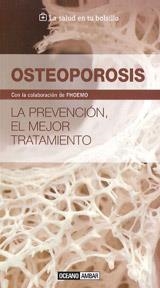 OSTOPOROSIS | 9788475567990