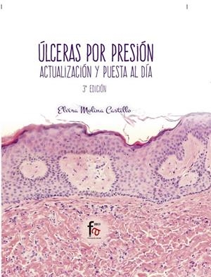 ÚLCERAS POR PRESIÓN. ACTUALIZACIÓN Y PUESTA AL DÍA (3ª EDICIÓ) | 9788491496328 | MOLINA CASTILLO, ELVIRA