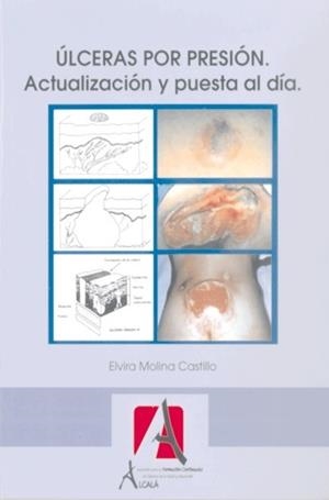 ULCERAS POR PRESION, ACTUALIZACIONES Y PUESTA AL DÍA | 9788485539567 | MOLINA CASTILLO, ELVIRA