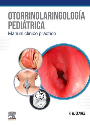 OTORRINOLARINGOLOGIA PEDIATRICA | 9788491135258 | CLARKE, R. W.