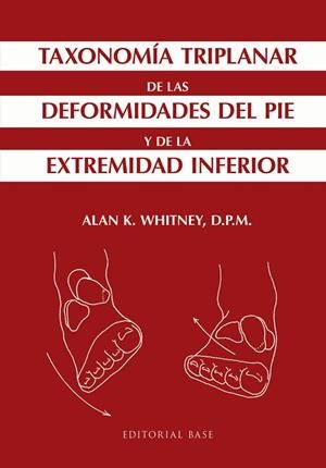 TAXONOMÍA TRIPLANAR DE LAS DEFORMIDADES DEL PIE Y DE LA EXTREMIDAD INFERIOR | 9788415706779 | WHITNEY, ALAN K.