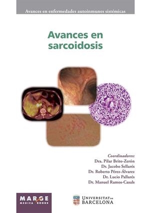 AVANCES EN SARCOIDOSIS | 9788417903343 | CERVERA, RICARD