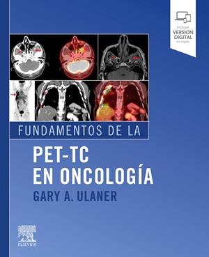 FUNDAMENTOS DE LA PET-TC EN ONCOLOGÍA | 9788491136736 | ULANER, G. A.