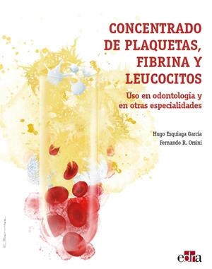 CONCENTRADO DE PLAQUETAS, FIBRINA Y LEUCOCITOS. USO EN ODONTOLOGÍA Y EN OTRAS ESPECIALIDADES | 9788418020322 | ESQUIAGA GARCIA, HUGO