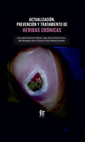 ACTUALIZACIÓN, PREVENCIÓN Y TRATAMIENTO DE HERIDAS CRÓNICAS | 9788413239729 | MORENO / ALMARCHA