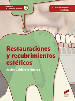 RESTAURACIONES Y RECUBRIMIENTOS ESTÉTICOS (2ª EDICIÓN REVISADA Y AMPLIADA) | 9788490772775 | CALDERERO SUÁREZ, JAVIER