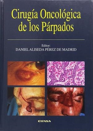CIRUGÍA ONCOLÓGICA DE LOS PÁRPADOS | 9788431317201