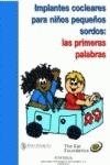 IMPLANTES COCLEARES PARA NIÑOS PEQUEÑOS SORDOS | 9788431324797