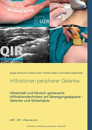 INFILTRATIONEN PERIPHERER GELENKE | 9783741267086 | TAMBORRINI, GIORGIO / KREBS, ANDREAS / DEJACO, CHRIS
