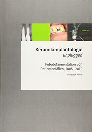 KERAMIKIMPLANTOLOGIE UNPLUGGED | 9783749478675 | ARLOM, CHRISTOPH