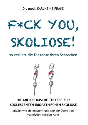 F*CK YOU, SKOLIOSE! SO VERLIERT DIE DIAGNOSE IHREN SCHRECKEN | 9783750441125 | FRANK, KARLHEINZ